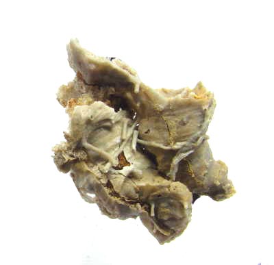 This fossil is called Prorichtofenia permiana . It is an inarticulate brachiopod from the Permian Period.