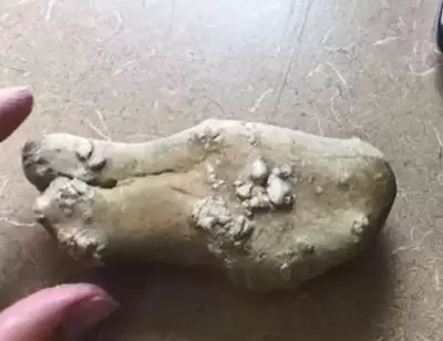 Tooth or Rock